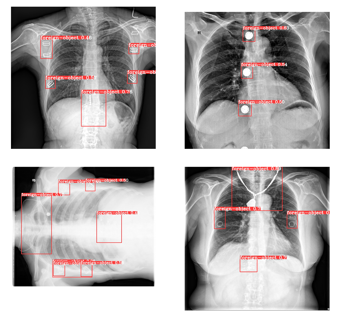 Foreign Object Detection in X-rays using YOLOv5 and YOLOv6